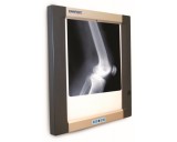 Daray Double Panel X-Ray Viewer 