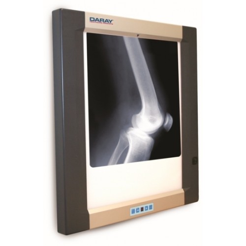 Daray Double Panel X-Ray Viewer 